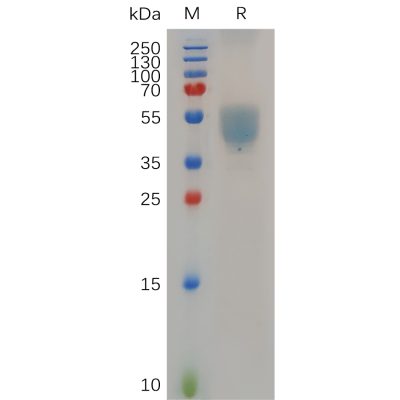 Recombinant Human GPR75 Protein, hFc Tag